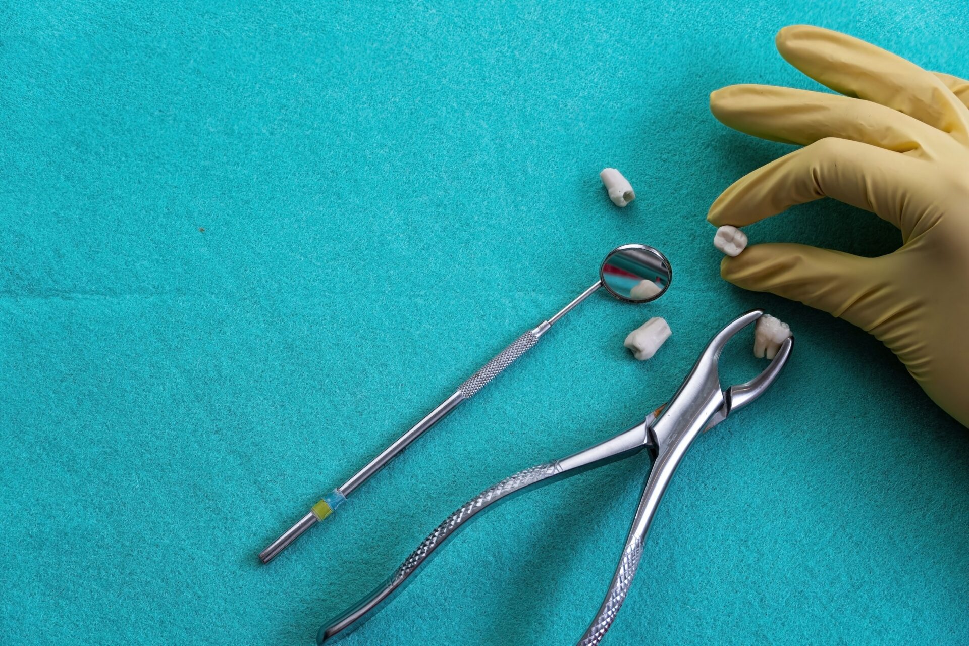 Closeup of a tooth extraction with forceps on a blue surface - brandon, fl